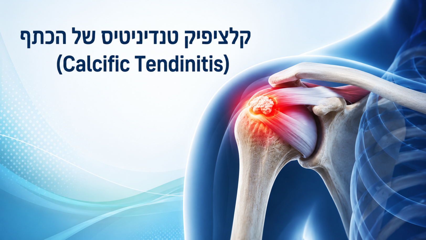 קלציפיק טנדיניטיס של הכתף (Calcific Tendinitis)