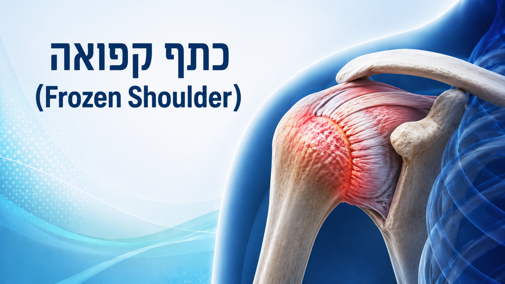Frozen Shoulder