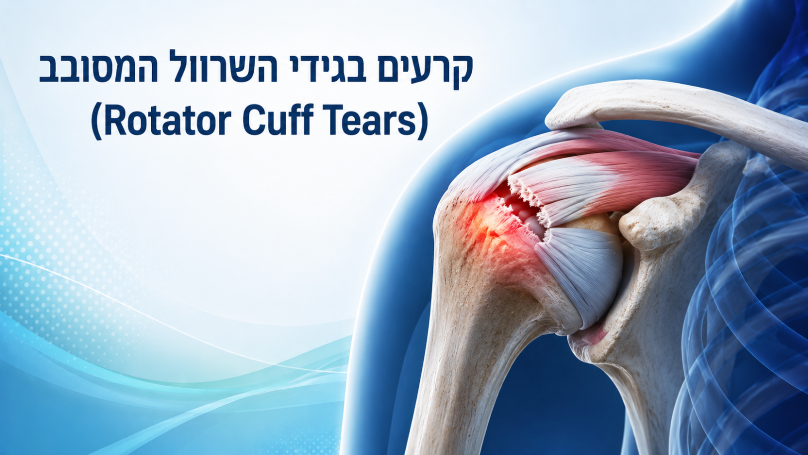 Rotator Cuff Tears